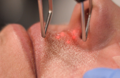 Dermatologia Clínica Impact 1